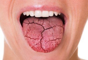 Dry mouth: How to keep your oral health flowing