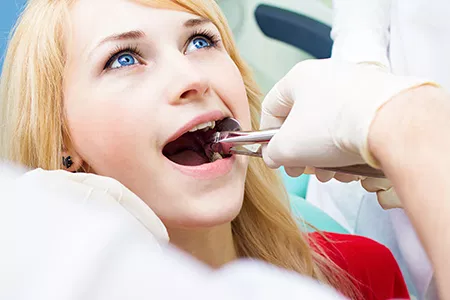 How is a tooth extraction performed