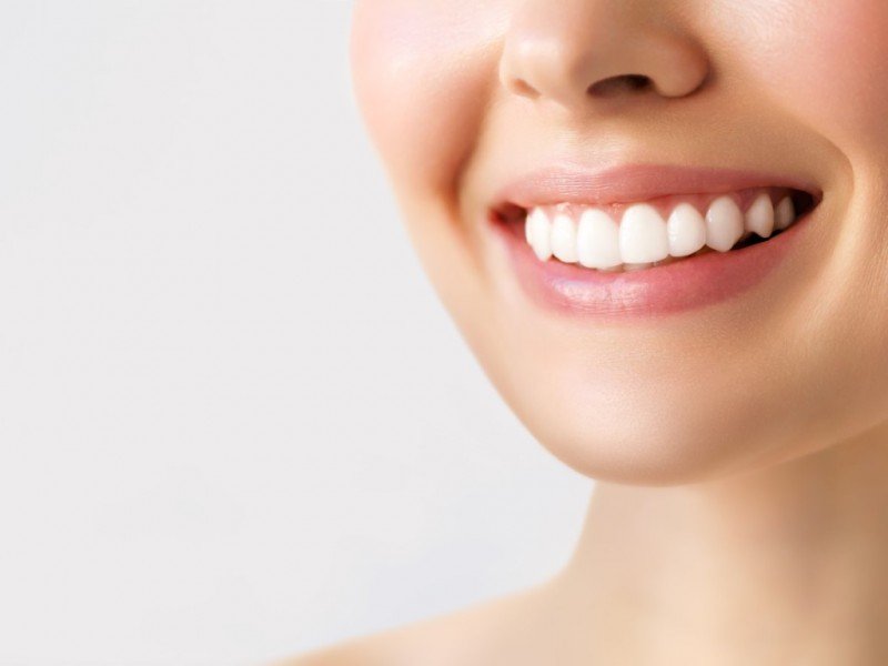 Professional Teeth Whitening Can Work Wonders For Your Smile | Churchville Dentist