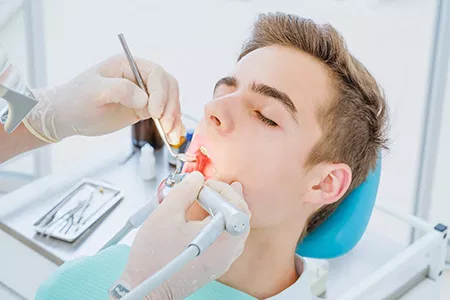 Different types of dental fillings