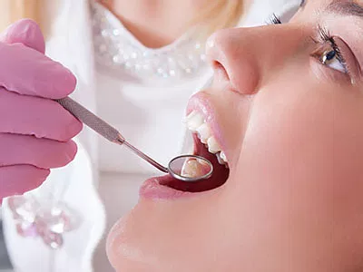 System Images Services Dental Dental Fillings